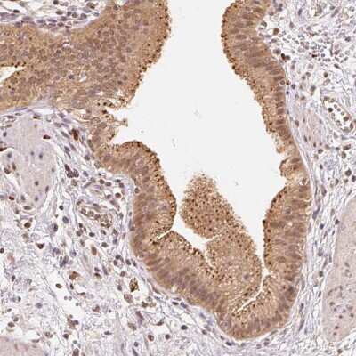 Immunohistochemistry-Paraffin: beta-Glucuronidase/GUSB Antibody [NBP2-38293]