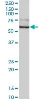 Western Blot: beta-Glucuronidase/GUSB Antibody [H00002990-B01P]