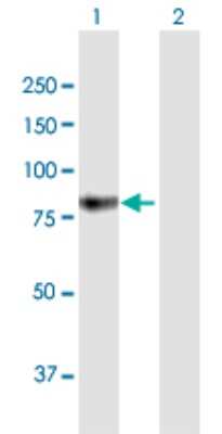 Western Blot: beta-Glucuronidase/GUSB Antibody [H00002990-B01P]