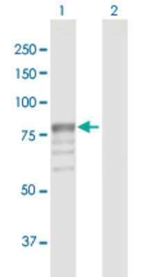 Western Blot: beta-Glucuronidase/GUSB Antibody [H00002990-D01P]