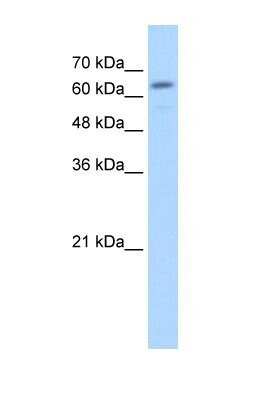 Western Blot: beta-Glucuronidase/GUSB Antibody [NBP1-69355]