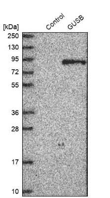 Western Blot: beta-Glucuronidase/GUSB Antibody [NBP1-87511]