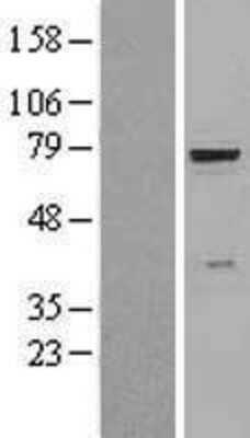 Western Blot: beta-Glucuronidase/GUSB Overexpression Lysate [NBL1-11412]