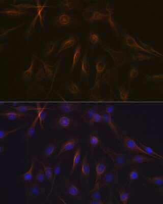 Immunocytochemistry/ Immunofluorescence: beta I Tubulin Antibody (2Z6P1) [NBP3-15928]