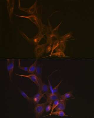 Immunocytochemistry/ Immunofluorescence: beta I Tubulin Antibody (2Z6P1) [NBP3-15928]