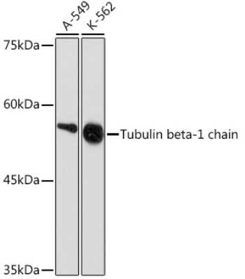 Western Blot: beta I Tubulin Antibody (2Z6P1) [NBP3-15928]