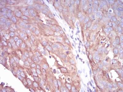 Immunohistochemistry-Paraffin: beta I Tubulin Antibody (2A1A9) - BSA Free [NBP2-52577]