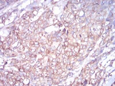 Immunohistochemistry-Paraffin: beta I Tubulin Antibody (2A1A9) - BSA Free [NBP2-52577]