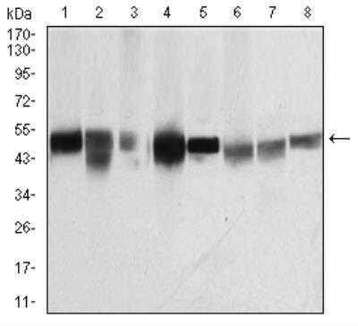 Western Blot: beta I Tubulin Antibody (2A1A9)BSA Free [NBP2-52577]