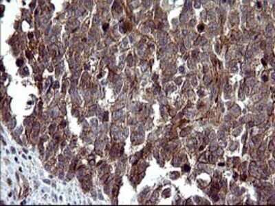 Immunohistochemistry: beta I Tubulin Antibody (OTI4A3) - Azide and BSA Free [NBP2-72225]