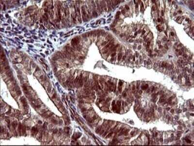 Immunohistochemistry: beta I Tubulin Antibody (OTI4A3) - Azide and BSA Free [NBP2-72225]