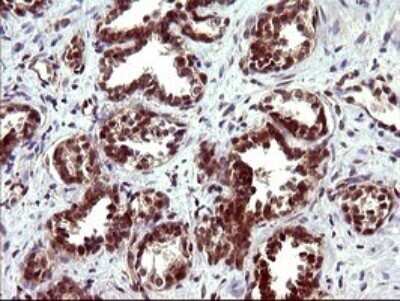 Immunohistochemistry: beta I Tubulin Antibody (OTI4A3) - Azide and BSA Free [NBP2-72225]