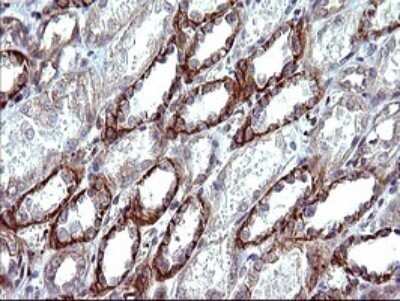 Immunohistochemistry: beta I Tubulin Antibody (OTI4A3) - Azide and BSA Free [NBP2-72225]