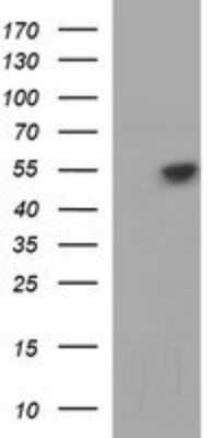 Western Blot: beta I Tubulin Antibody (OTI4A3)Azide and BSA Free [NBP2-72225]