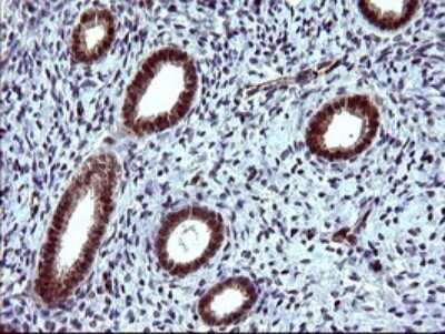 Immunohistochemistry: beta I Tubulin Antibody (OTI4A3) [NBP2-46245]