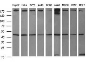 Western Blot: beta I Tubulin Antibody (OTI4A3) [NBP2-46245]