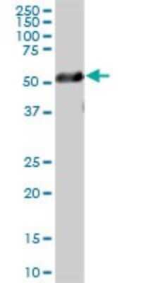 Western Blot: beta I Tubulin Antibody [H00081027-B01P]