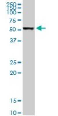 Western Blot: beta I Tubulin Antibody [H00081027-D01P]