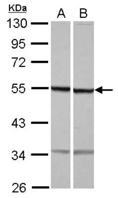 Western Blot: beta I Tubulin Antibody [NBP2-14885]