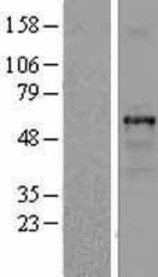 Western Blot: beta I Tubulin Overexpression Lysate [NBL1-17436]