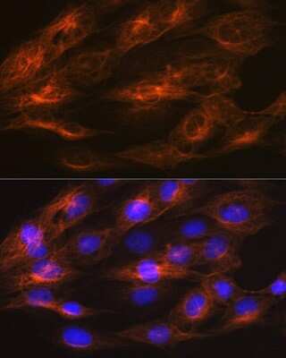 Immunocytochemistry/ Immunofluorescence: beta II Tubulin A Antibody (1R3R9) [NBP3-16484]