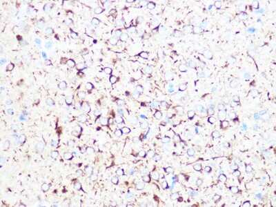 Immunohistochemistry-Paraffin: beta II Tubulin A Antibody (1R3R9) [NBP3-16484]