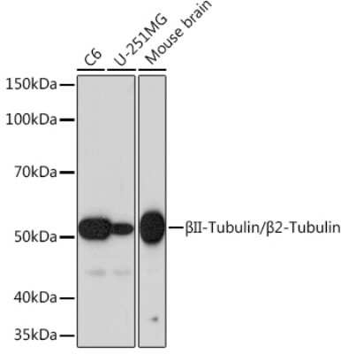 Western Blot: beta II Tubulin A Antibody (1R3R9) [NBP3-16484]