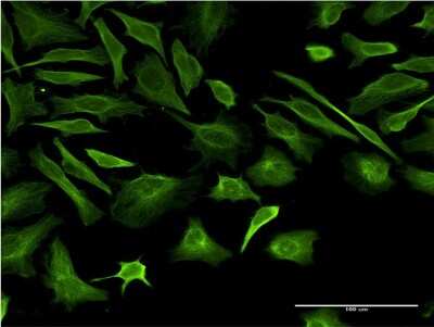 Immunocytochemistry/ Immunofluorescence: beta II Tubulin A Antibody (2B2) [H00007280-M03]