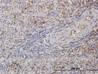 Immunohistochemistry-Paraffin: beta II Tubulin A Antibody (2B2) [H00007280-M03]