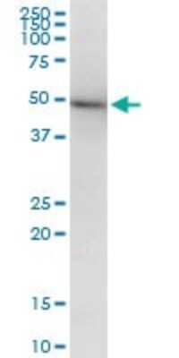 Western Blot: beta II Tubulin A Antibody (2B2) [H00007280-M03]
