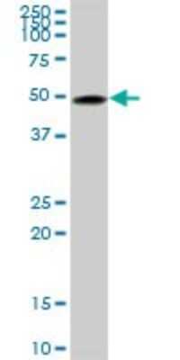 Western Blot: beta II Tubulin A Antibody (2B2) [H00007280-M03]