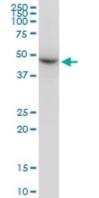 Western Blot: beta II Tubulin A Antibody (2B2) [H00007280-M03]