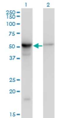 Western Blot: beta II Tubulin A Antibody (2B2) [H00007280-M03]