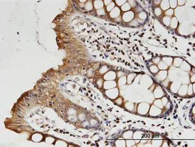 Immunohistochemistry-Paraffin: beta II Tubulin A Antibody (3B2) [H00007280-M04]