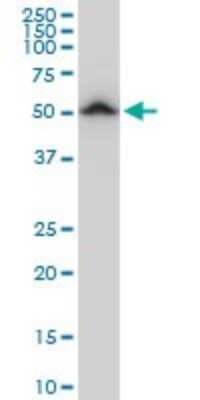 Western Blot: beta II Tubulin A Antibody (3B2) [H00007280-M04]
