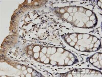 Immunohistochemistry-Paraffin: beta II Tubulin A Antibody (3C12) [H00007280-M02]