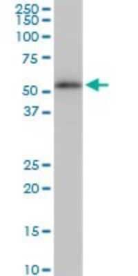 Western Blot: beta II Tubulin A Antibody (3C12) [H00007280-M02]