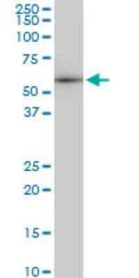 Western Blot: beta II Tubulin A Antibody (3C12) [H00007280-M02]