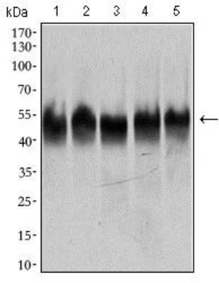 Western Blot: beta II Tubulin A Antibody (6A10B2)BSA Free [NBP2-37376]