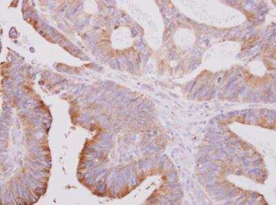 Immunohistochemistry-Paraffin: beta II Tubulin A Antibody [NBP2-15580]