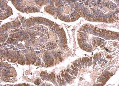 Immunohistochemistry-Paraffin: beta II Tubulin A Antibody [NBP2-15581]
