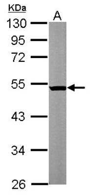 Western Blot: beta II Tubulin A Antibody [NBP2-15580]