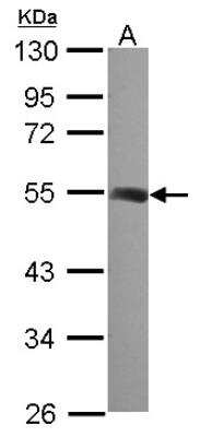 Western Blot: beta II Tubulin A Antibody [NBP2-15580]