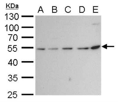 Western Blot: beta II Tubulin A Antibody [NBP2-15581]