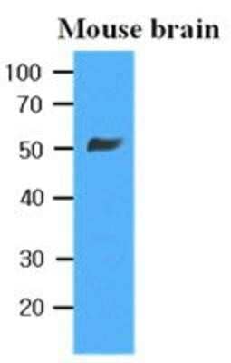 Western Blot: beta II Tubulin B Antibody (5B2)BSA Free [NBP1-74037]