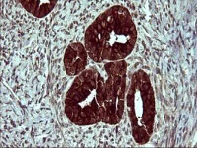 Immunohistochemistry: beta II Tubulin B Antibody (OTI6D11) - Azide and BSA Free [NBP2-72505]