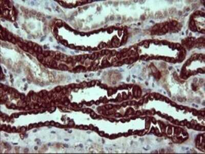 Immunohistochemistry: beta II Tubulin B Antibody (OTI6D11) - Azide and BSA Free [NBP2-72505]