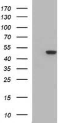 Western Blot: beta II Tubulin B Antibody (OTI6D11)Azide and BSA Free [NBP2-72505]