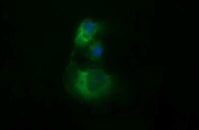 Immunocytochemistry/ Immunofluorescence: beta II Tubulin B Antibody (OTI6D11) [NBP2-46250]