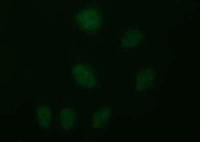 Immunocytochemistry/ Immunofluorescence: beta II Tubulin B Antibody (OTI6D11) [NBP2-46250]